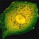microscopic image of oncogene dyed yellow and green