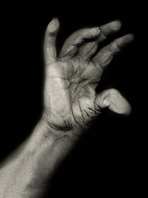 photo of a hand