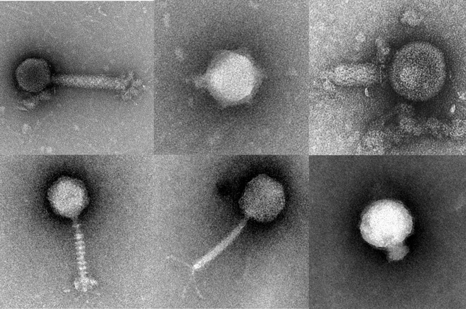 Transmission electron micrographs of viruses