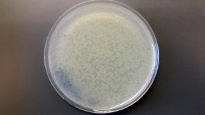 bacteria in a lab dish