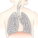 UH researchers get $2.8M to study smoking-related lung cancer disparities