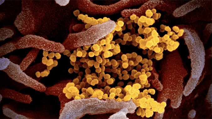 photo of SARS-CoV-2 virus