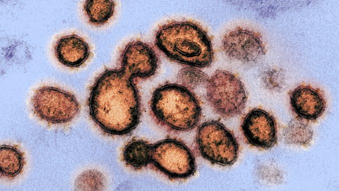 Imagen del virus que causa el covid-19