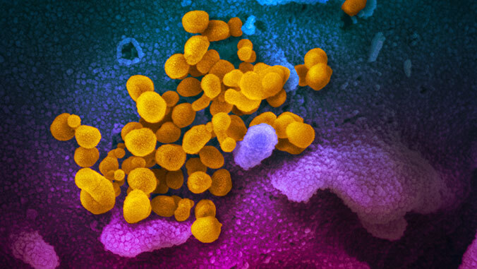 microscopic image of coronavirus