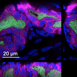 sRNA under the microscope