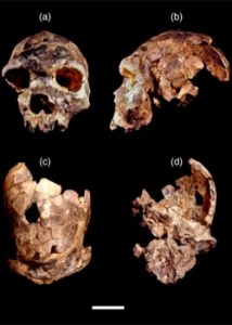 photos of pieces of skull
