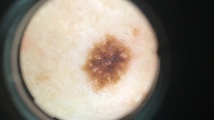 microscopic image of mole