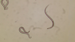 rat lungworm