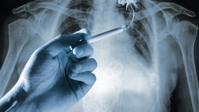 Mano con cigarrillo frente a la imagen de rayos X del abdomen humano